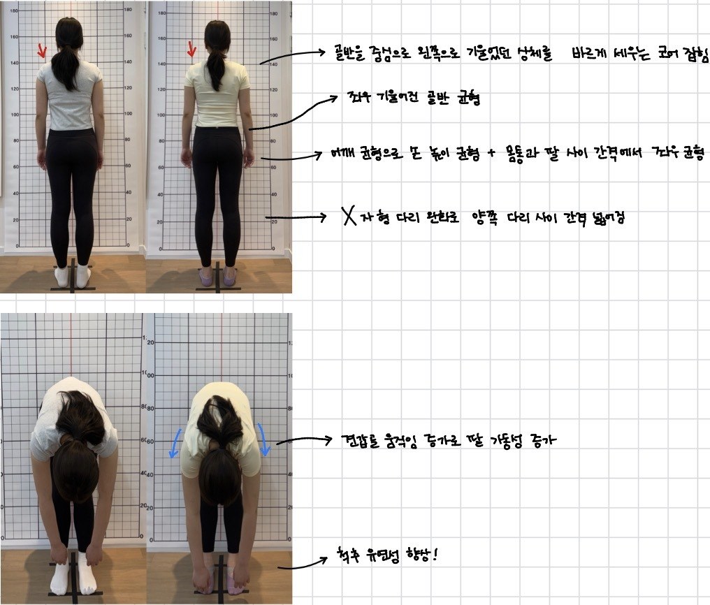 후면·전굴 체형 변화 비교, 바디엔필라테스 1:1 개인레슨
